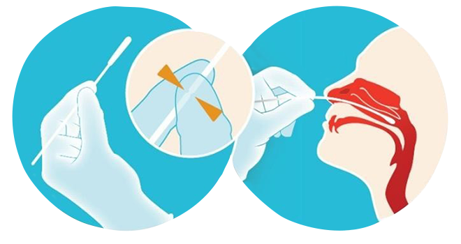 Nasopharyngeal Specimen Collection