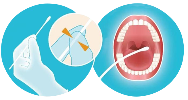 Oropharyngeal Specimen Collection